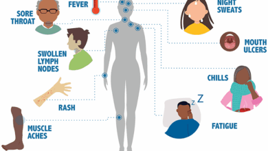 Symptoms of HIVAid